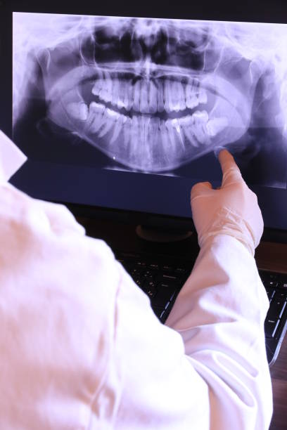 Best Emergency Dental Extractions in Cleves, OH